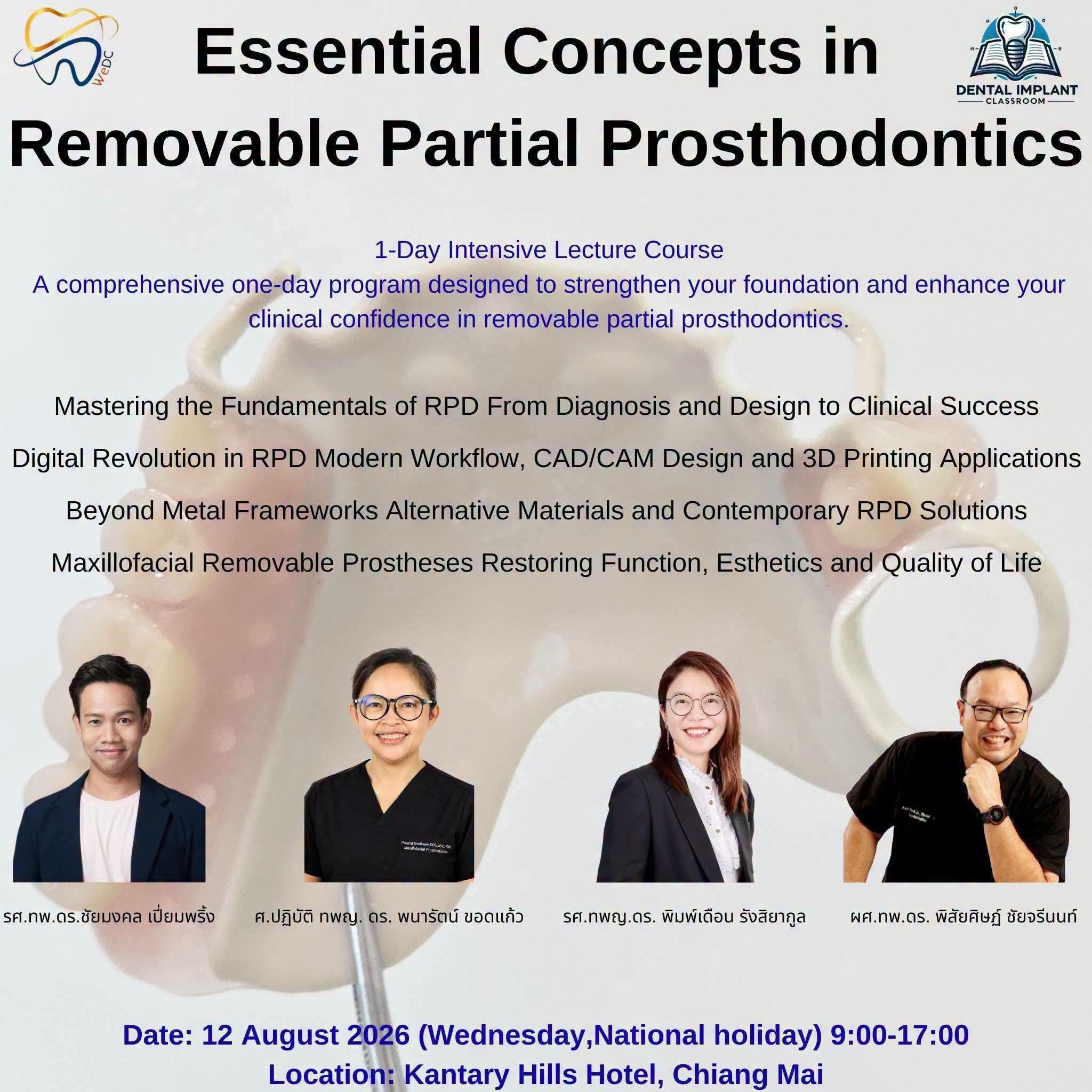 Essential Concepts in Removable Partial Prosthodontics