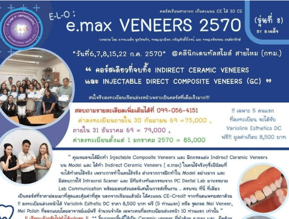 e.max Veneers 2570